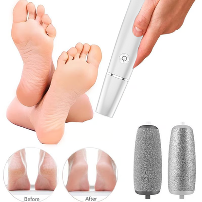 🔥LAST DAY SALE 75% OFF🔥Electric Feet Callus Remover