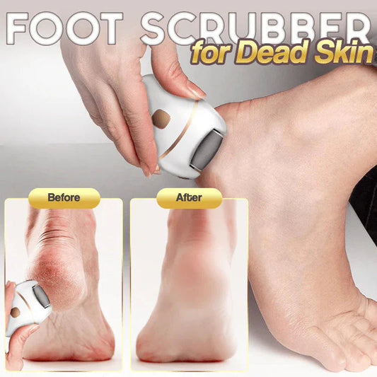 🔥LAST DAY PROMOTION SALE 49% OFF🔥Rechargeable Electric Foot Exfoliating Scrubber