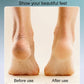 🔥Year-End Sales - 50% OFF 🎄🎁Rechargeable Electric Foot Callus Remover
