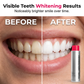 ⏳LAST DAY BUY 2 GET 1  FREE!!😁✨50K+ SOLD!💞PearlGlow™ Stain‑Removing Whitening Mouthwash – Lifts coffee & tea stains, alcohol‑free. Instant gunk binding, long‑lasting minty fresh. Gentle enough for daily use. 🦷💙