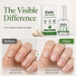 🔥 50% OFF 💅 Garlic Nail Strengthening Polish – Helps Weak, Brittle & Damaged Nails Look Stronger ✨